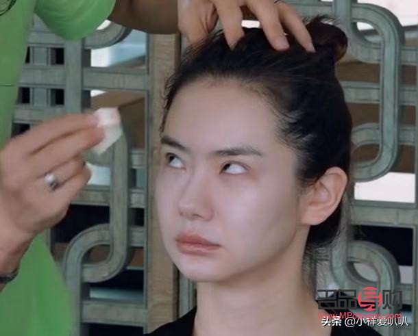 雙眼皮手術(shù)有沒有后遺癥呢圖片(雙眼皮手術(shù)有沒有后遺癥呢圖片大全)