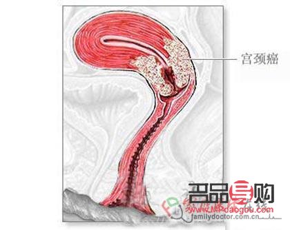<h3>刮宮后身體護(hù)理全攻略</h3>