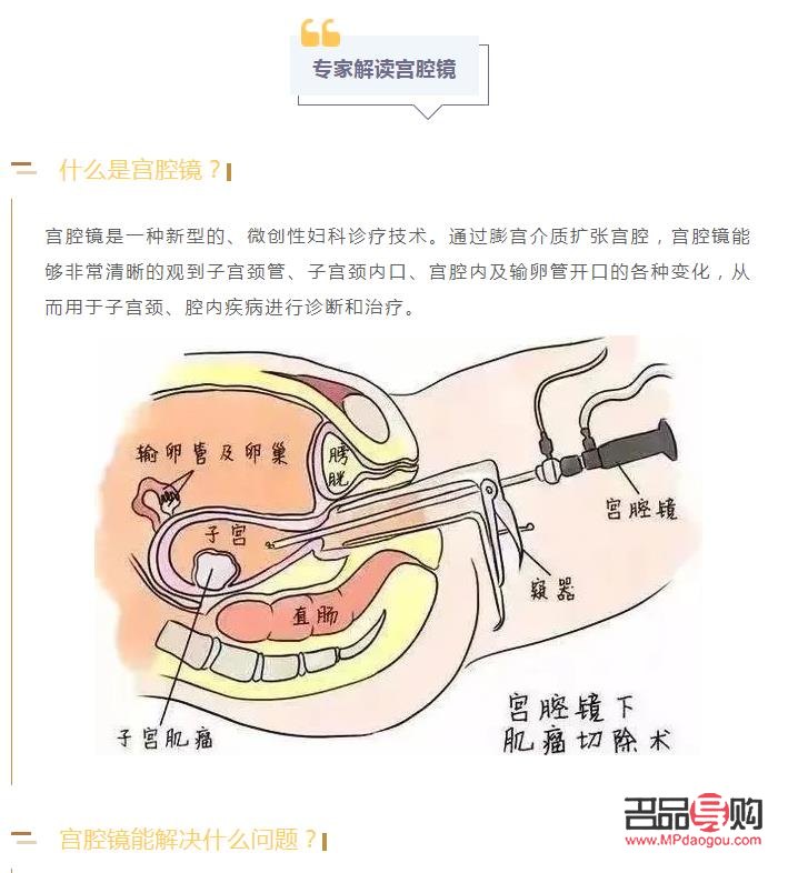 刮宮后身體護(hù)理全攻略