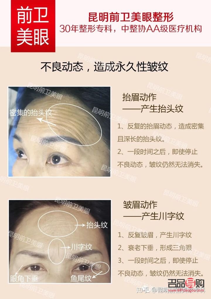 <h3>眼部打營養針，除皺效果究竟如何？</h3>