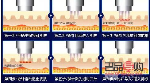 微針后的身體護理全攻略