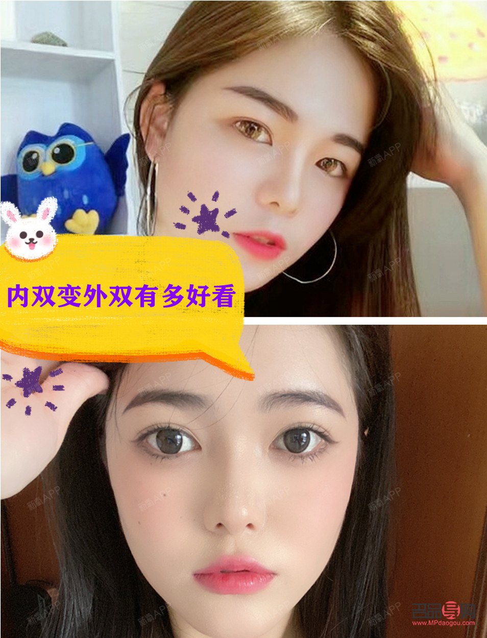雙眼皮內雙圖片(雙眼皮內雙和外雙的區別圖片)