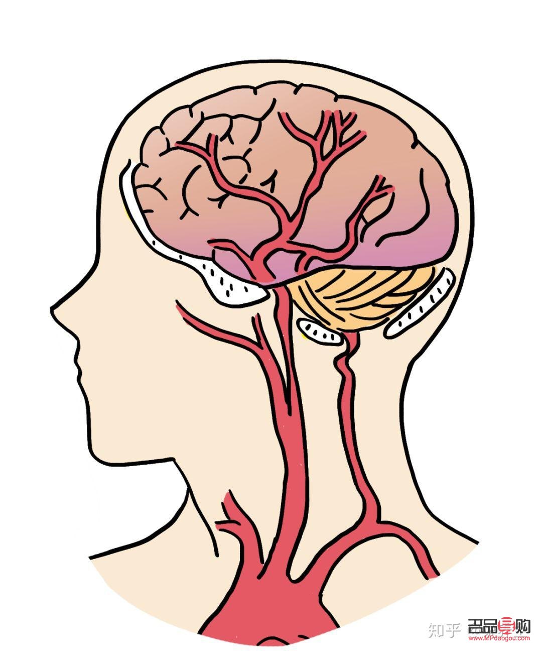 腦梗患者送禮指南