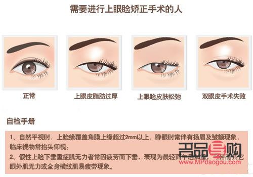 眼角下垂鍛煉秘籍：重拾青春眼神