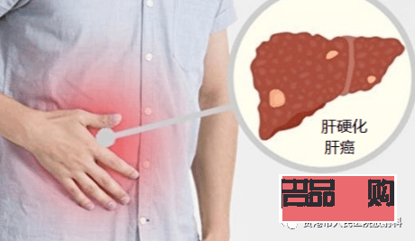 肝癌晚期怎么護理身體(肝癌晚期怎么護理身體好)