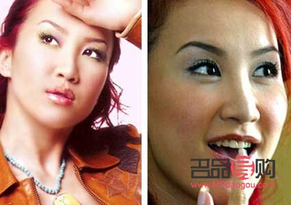 <h3>選擇雙眼皮貼，打造迷人電眼</h3>