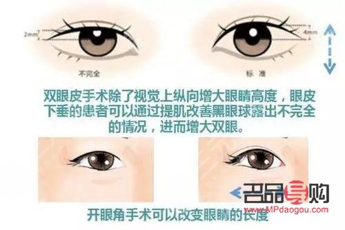 <h3>開眼角與不開眼角的區別圖解</h3>