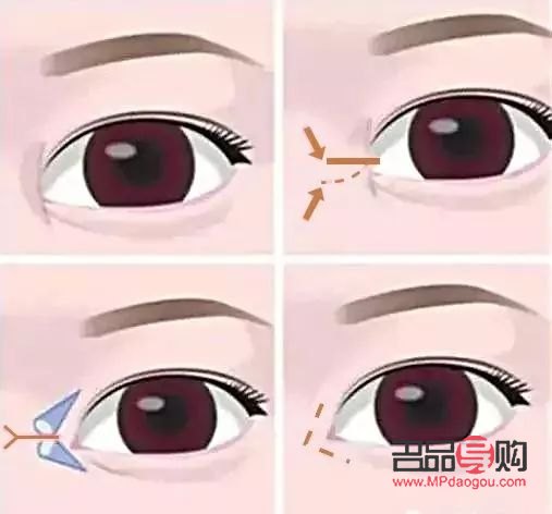 開眼角與不開眼角的區別圖解