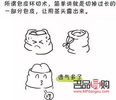 美容包皮手術嗎(美容包皮手術嗎會復發嗎)