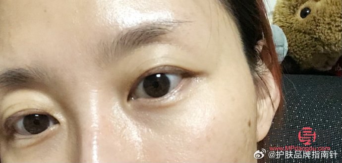 <h3>天生腫眼泡熱敷是否有用？</h3>