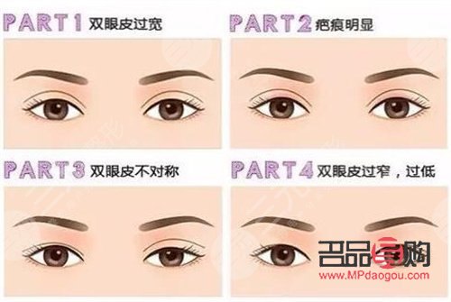雙眼皮圖片 效果圖女生(雙眼皮圖片 效果圖女生可愛)