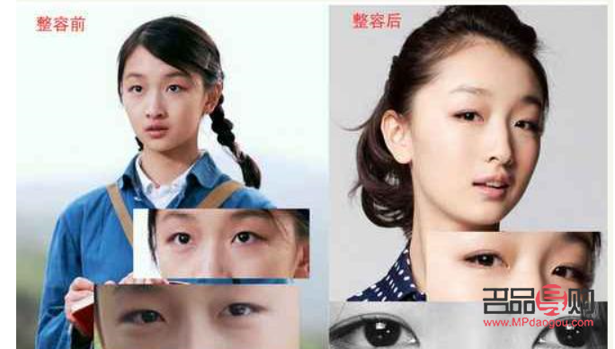 眼皮埋線和割雙眼皮有什么區別(眼皮埋線和割雙眼皮有什么區別嗎)