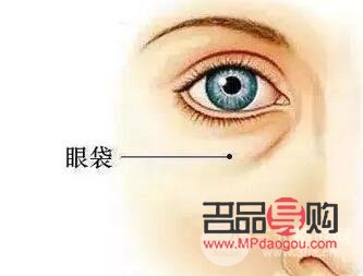 內切眼袋需要拆線嗎(內切眼袋需要拆線嗎圖片)