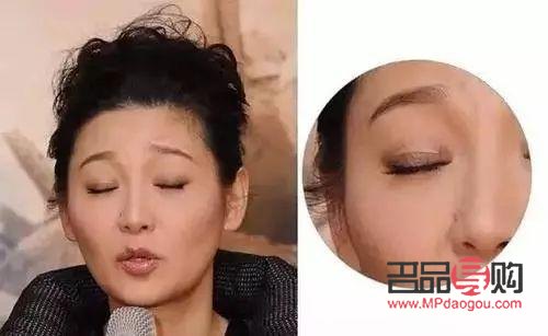 大眼綜合與小眼綜合：眼部整形手術的不同選擇