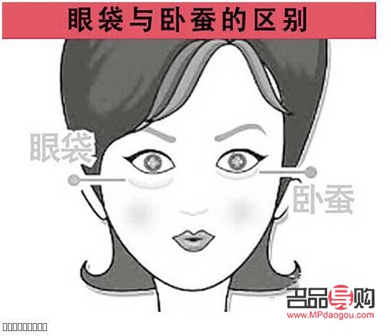 如何準確區分眼袋與臥蠶？圖片對比解析