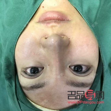 無痛割雙眼皮：真的無痛嗎？