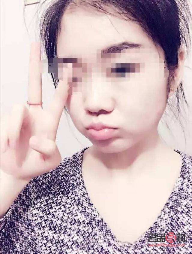 10秒成型雙眼皮圖片(10秒成型雙眼皮圖片真實)