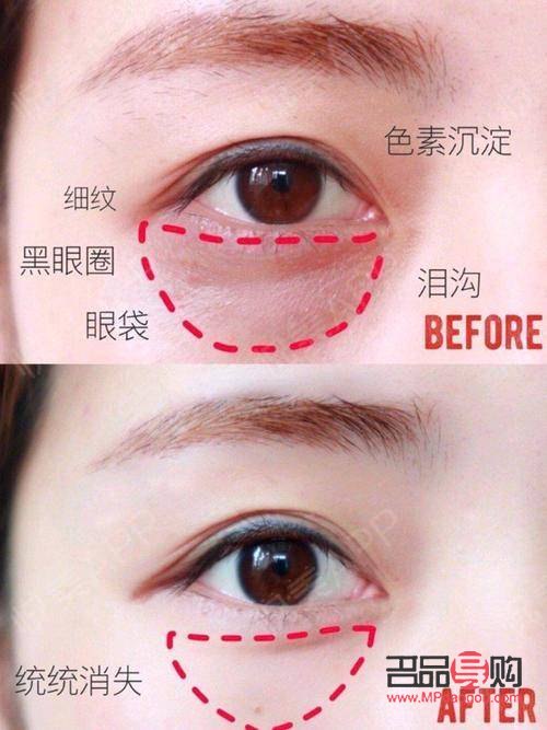 淚溝化妝技巧：如何巧妙遮住眼袋