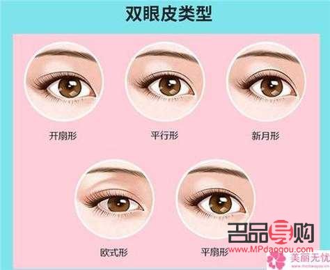 雙眼皮手術(shù)能否二次操作及費(fèi)用探討