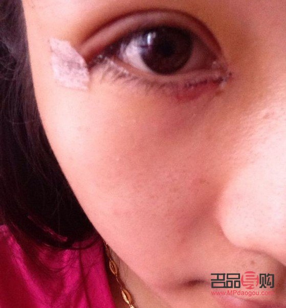 微創雙眼皮多久可以恢復自然眼皮(微創雙眼皮多久可以恢復自然眼皮了)