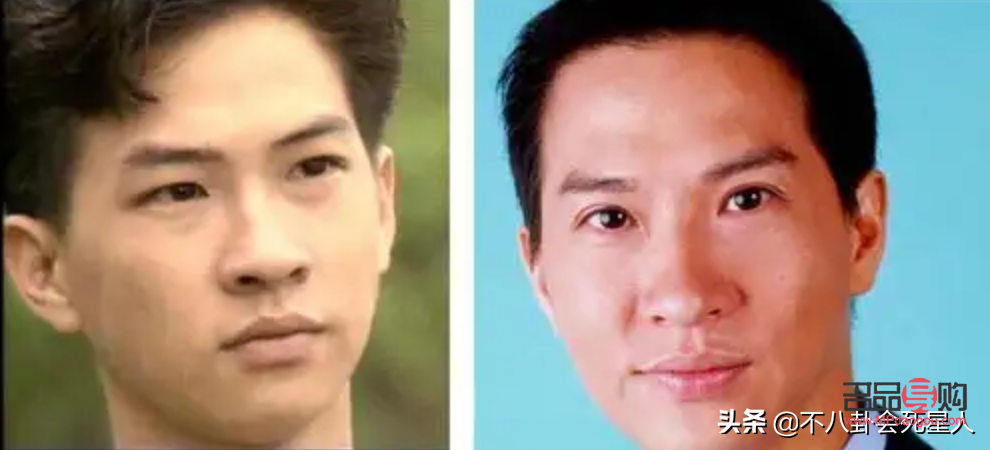 哪種割雙眼皮最自然的(哪種割雙眼皮最自然的圖片)