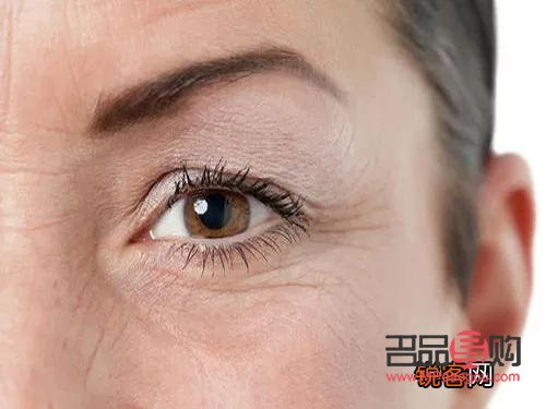 眼睛下面干紋越來越多怎么辦(眼下已經形成的干紋怎么去除)