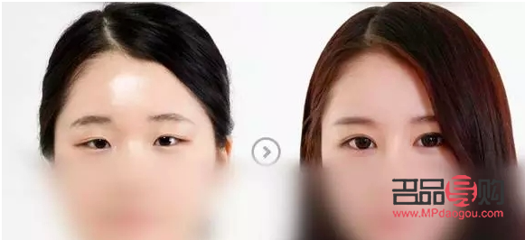 如何改善大小眼問題(如何改善大小眼問題的方法)