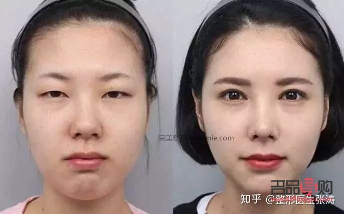如何改善大小眼問題(如何改善大小眼問題的方法)