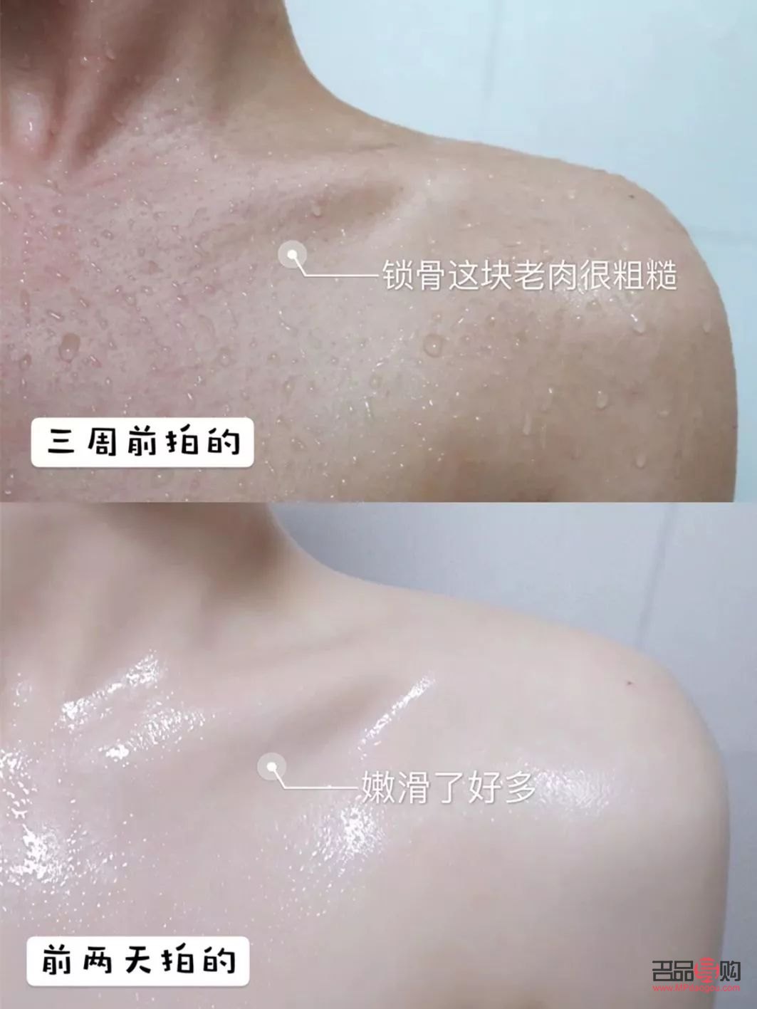 明星身體干燥怎么護理(明星身體干燥怎么護理好)