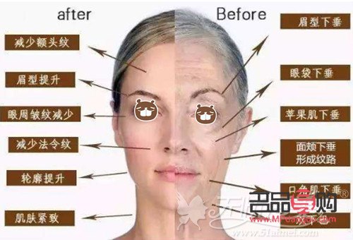 <h3>眼部超聲炮的效果深度解析</h3>