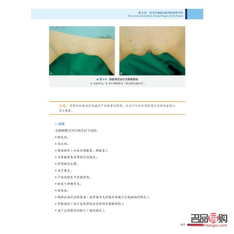 <h3>美容瘢痕：了解、預(yù)防與治療</h3>