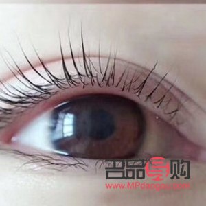 雙眼皮翹睫手術原理詳解