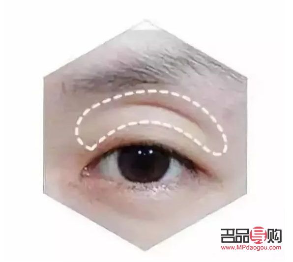 深眼窩和眼窩凹陷的區別(深眼窩和眼窩凹陷的區別圖解)