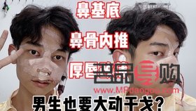 日式無痕雙眼皮是什么原理(日式無痕雙眼皮是什么原理做的)