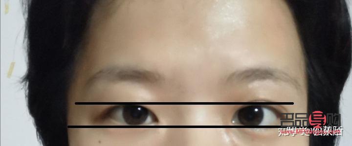 眼睛一大一小怎么糾正多少錢(眼睛一大一小怎么改)