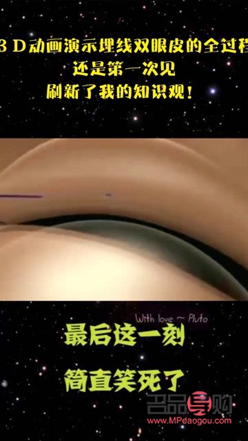 3d演示割雙眼皮(3d演示割雙眼皮視頻)