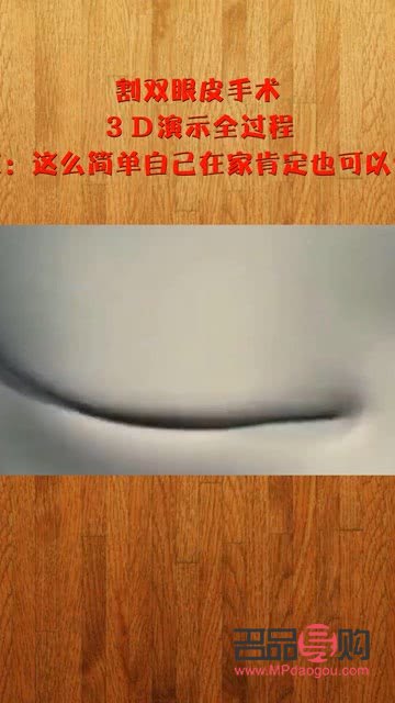 3d演示割雙眼皮(3d演示割雙眼皮視頻)