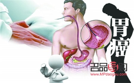 怎么護(hù)理癌癥患兒身體(怎么護(hù)理癌癥患兒身體健康)