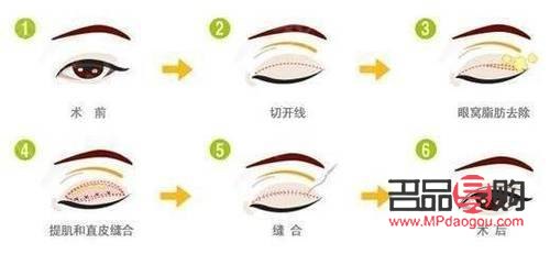 眼綜合是指哪些項目(眼綜合是指什么)