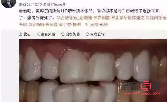 美容院怎么看牙齒(美容院怎么看牙齒好壞)