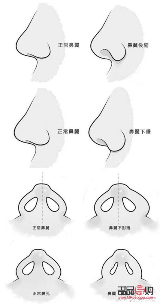 <h3>美容隆鼻價格探究：了解隆鼻手術的費用與價值</h3>