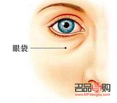 去除眼袋的藥膏選擇指南