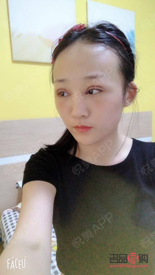 割雙眼皮需要多久的時間做完(割雙眼皮需要多久的時間做完手術)
