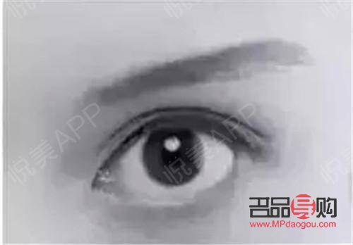 新月型雙眼皮的特點(diǎn)(新月型雙眼皮的特點(diǎn)有哪些)