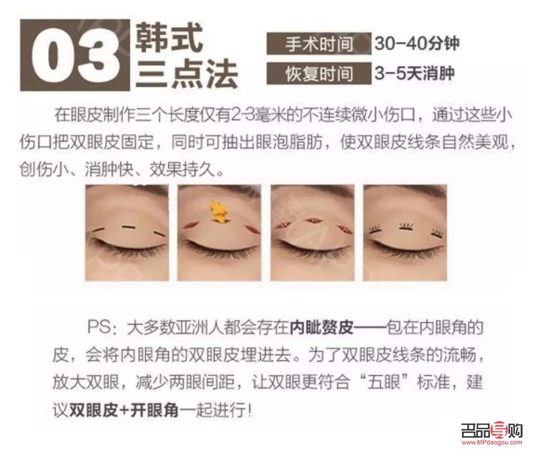 雙眼皮自然款是幾毫米(雙眼皮6mm效果)