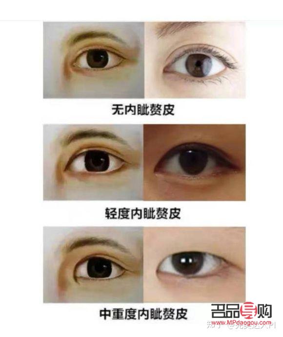 內眼角開大了有什么影響嗎(內眼角開大了有什么影響嗎)