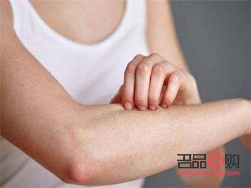 身體發(fā)癢怎么辦？有效護理方法大揭秘