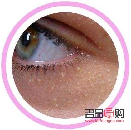 眼部衰老怎么修復最好(眼部衰老怎么修復最好的方法)
