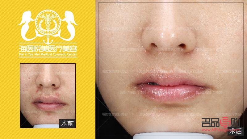 哪家整型美容好(哪家整型美容好)