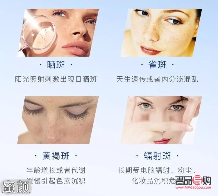 激光美容祛斑好嗎(激光美容祛斑好嗎多少錢)